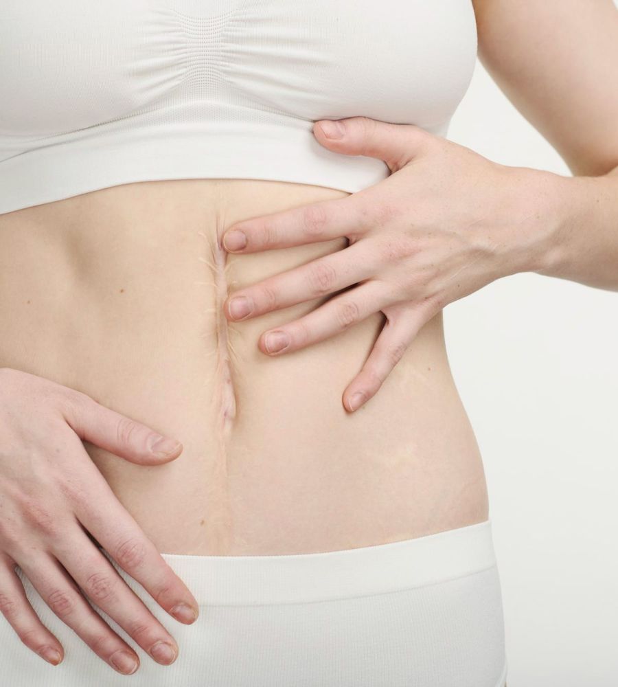 Trattamento / terapia delle cicatrici – Studio di osteopatia / Serena Noto