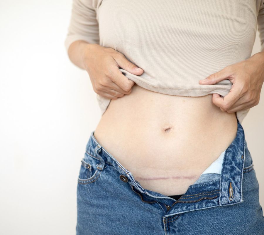 Trattamento / terapia delle cicatrici – Studio di osteopatia Serena Noto