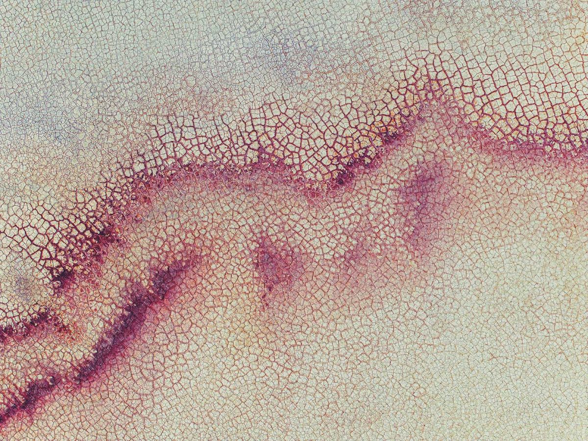 Mikroskopische Faszienstruktur mit netzartigem Bindegewebe – Symbol für Verklebungen und Gewebespannungen in der Narbenarbeit