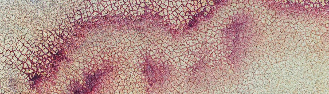 Trattamento / terapia delle cicatrici – Studio di osteopatia Serena Noto