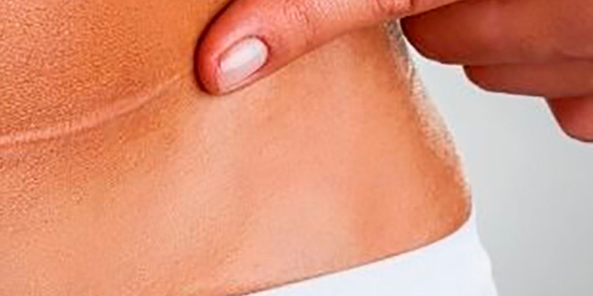 Narbentherapie nach dem Liedler Konzept - Praxis für Osteopathie - Serena Noto - Berlin Prenzlauer Berg