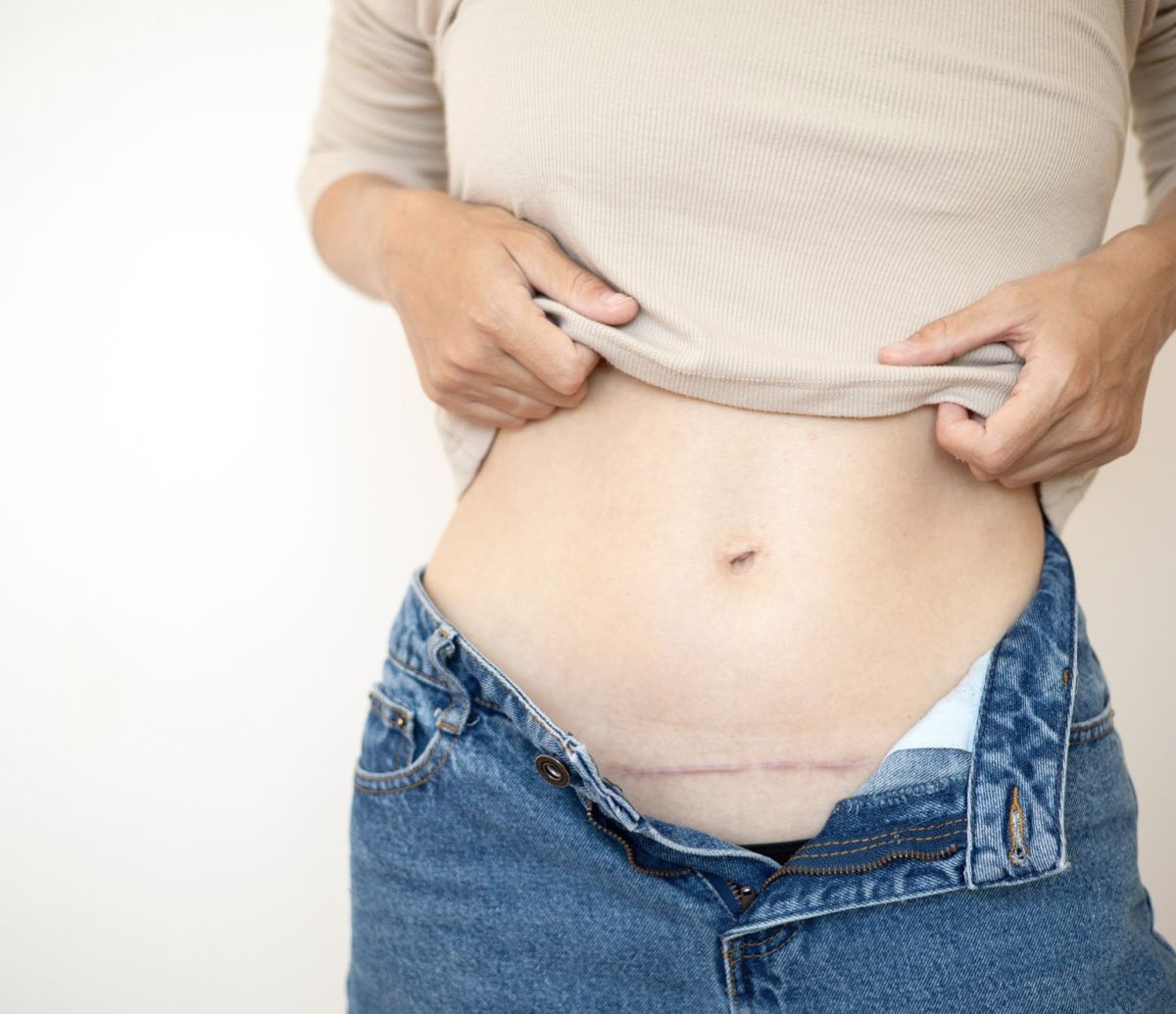 Trattamento delle cicatrici / Terapia delle cicatrici – Studio di Osteopatia Serena Noto