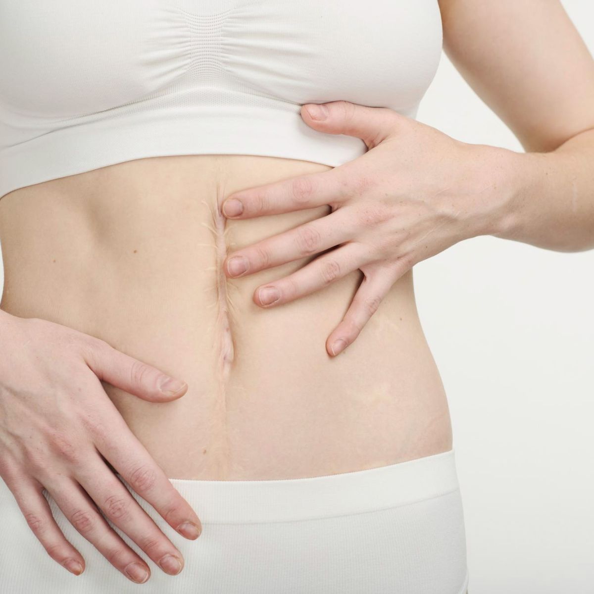 Narbenbehandlung / Narbentherapie - Praxis für Osteopathie / Serena Noto