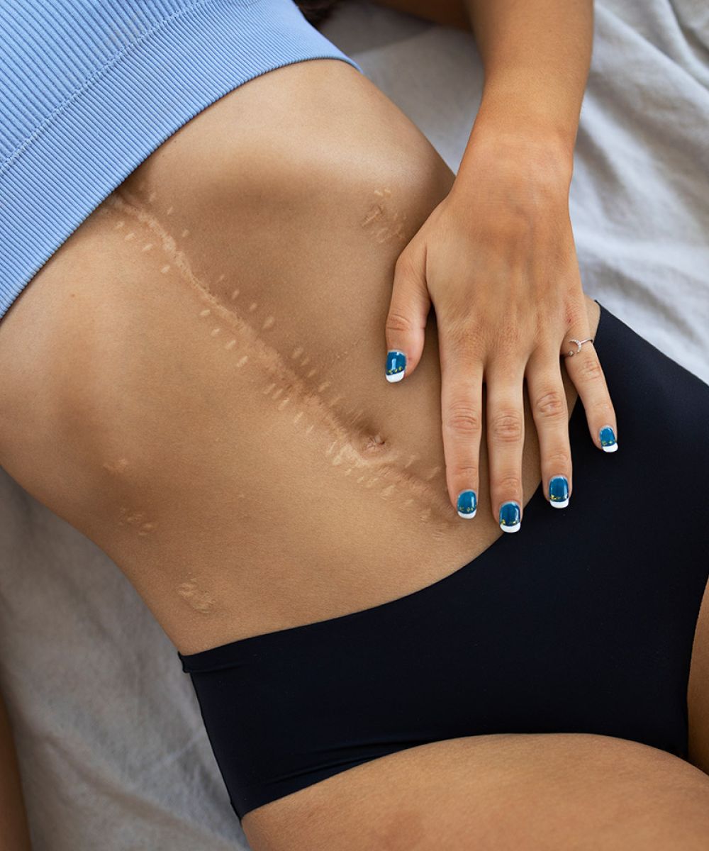 Narbentherapie, Narbenbehandlung, Berlin, Prenzlauer Berg